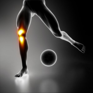Featured image: Return to sport after ACL surgery
