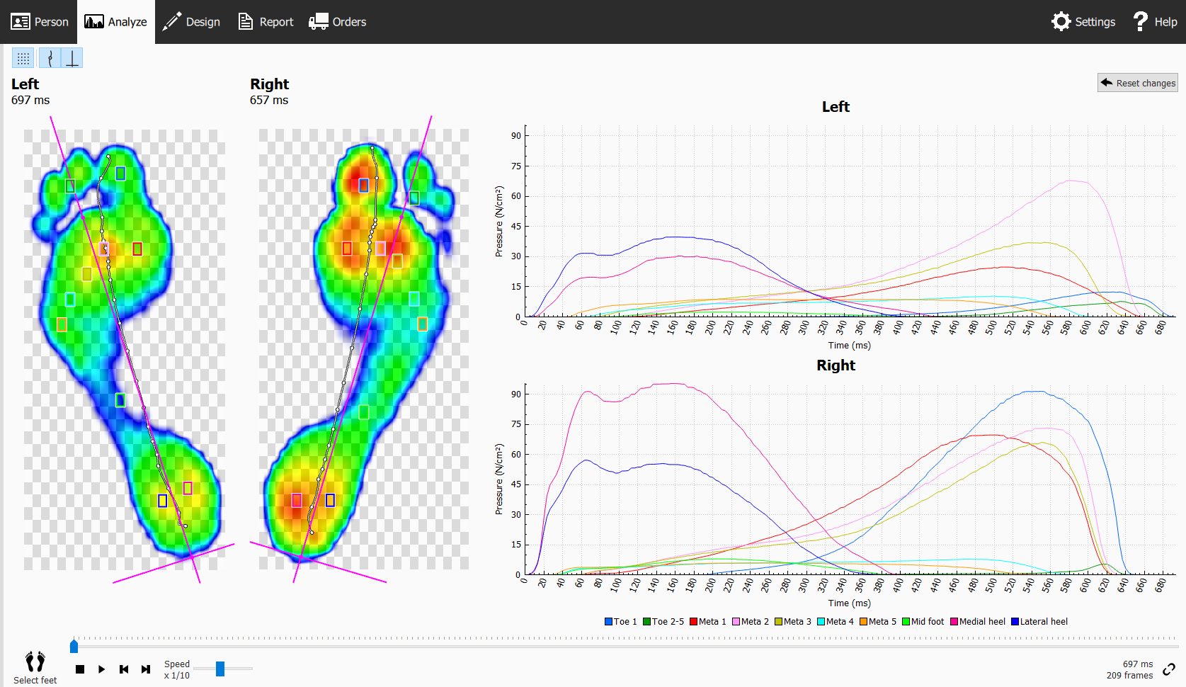 Custom Insoles Jesmond - Scan